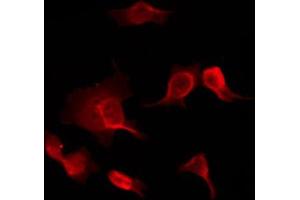 ABIN6267033 staining HuvEc by IF/ICC. (PIM1 抗体  (Internal Region))
