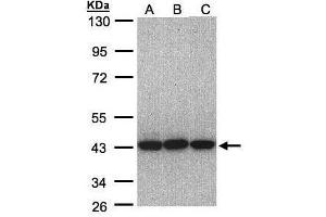 WB Image Sample(30 ug whole cell lysate) A:A431, B:H1299 C:Hep G2 , 10% SDS PAGE antibody diluted at 1:1000 (EIF3H 抗体)