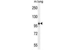 AEBP1 Antibody (Center) western blot analysis in mouse lung tissue lysates (35µg/lane). (AEBP1 抗体  (Middle Region))