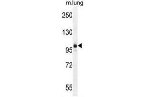 AEBP1 Antibody (Center) western blot analysis in mouse lung tissue lysates (35µg/lane). (AEBP1 抗体  (Middle Region))