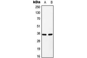 Western blot analysis of C/EBP alpha (pS193) expression in H9C2 (A), Raw264. (CEBPA 抗体  (pSer193))