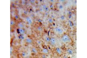 Used in DAB staining on fromalin fixed paraffin-embedded Brain tissue (DPYSL3 抗体  (AA 1-218))