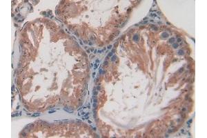 Used in DAB staining on fromalin fixed paraffin- embedded stomach tissue (SPTAN1 抗体  (AA 1004-1181))