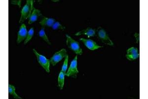 Immunofluorescent analysis of Hela cells using ABIN7152101 at dilution of 1:100 and Alexa Fluor 488-congugated AffiniPure Goat Anti-Rabbit IgG(H+L) (EEF2K 抗体  (AA 201-500))