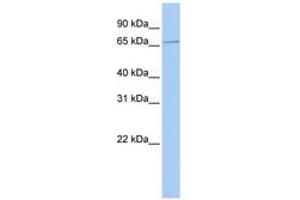 Image no. 1 for anti-Sex Comb On Midleg Homolog 1 (SCMH1) (AA 180-229) antibody (ABIN6740271) (SCMH1 抗体  (AA 180-229))