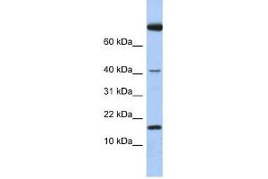 IL4 antibody used at 1 ug/ml to detect target protein. (IL-4 抗体  (Middle Region))