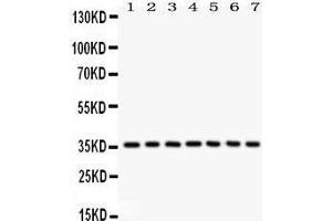 Western Blotting (WB) image for anti-Nuclear Factor of kappa Light Polypeptide Gene Enhancer in B-Cells Inhibitor, alpha (NFKBIA) (AA 3-112) antibody (ABIN3043889) (NFKBIA 抗体  (AA 3-112))