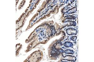 IHC analysis of SNRNP200 using anti-SNRNP200 antibody (ABIN7602032). (SNRNP200 抗体  (AA 557-2129))