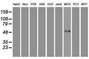 Image no. 2 for anti-Forkhead Box A1 (FOXA1) (AA 1-473) antibody (ABIN1490773) (FOXA1 抗体  (AA 1-473))
