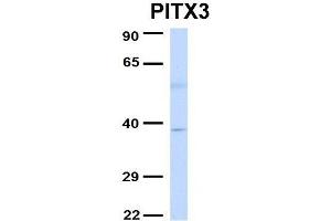 Host:  Rabbit  Target Name:  PITX3  Sample Type:  Human Fetal Liver  Antibody Dilution:  1. (PITX3 抗体  (Middle Region))