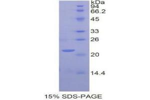 SDS-PAGE analysis of Human GaA Protein. (GAA 蛋白)