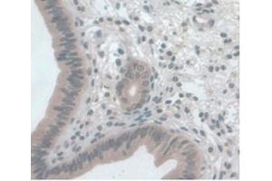 Detection of MCP1 in Mouse Uterus Tissue using Monoclonal Antibody to Monocyte Chemotactic Protein 1 (MCP1) (CCL2 抗体  (AA 24-96))