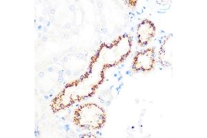 Immunohistochemistry of paraffin-embedded rat kidney using OSR1 Rabbit pAb (ABIN7269080) at dilution of 1:100 (40x lens). (OSR1 抗体)