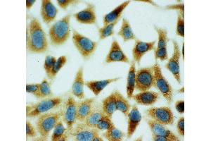 Anti-Annexin V antibody, ICC ICC: HELA Cell