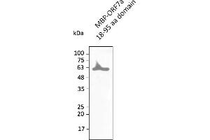 Western Blotting (WB) image for anti-SARS-CoV-2 ORF7a antibody (ABIN7272994) (SARS-CoV-2 ORF7a 抗体)