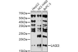 Western blot analysis of extracts of various cell lines, using L antibody (ABIN7268159) at 1:1000 dilution. (LAGE3 抗体  (AA 1-143))