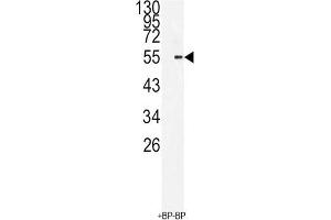 Western Blotting (WB) image for anti-BMI1 Polycomb Ring Finger Oncogene (BMI1) antibody (ABIN3001536) (BMI1 抗体)