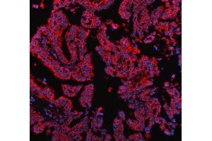 IF analysis of PDK2 using anti-PDK2 antibody (ABIN5693279).