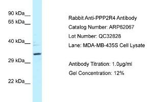 Western Blotting (WB) image for anti-Protein Phosphatase 2A Activator, Regulatory Subunit 4 (PPP2R4) (N-Term) antibody (ABIN2789005)