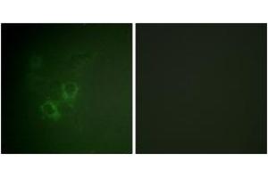 Immunofluorescence analysis of HeLa cells, using AhR (Ab-36) Antibody. (Aryl Hydrocarbon Receptor 抗体  (AA 2-51))