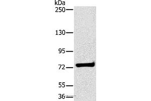 Western blot analysis of K562 cell, using HSD17B4 Polyclonal Antibody at dilution of 1:400 (HSD17B4 抗体)