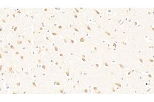 Detection of PURA in Human Cerebrum Tissue using Polyclonal Antibody to Purine Rich Element Binding Protein A (PURA) (PURA 抗体  (AA 1-322))