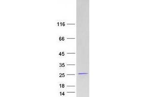 Western Blotting (WB) image for Ring Finger Protein 181 (RNF181) protein (Myc-DYKDDDDK Tag) (ABIN2731040)