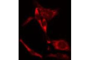 ABIN6275647 staining NIH-3T3 cells by IF/ICC. (PEAK1 抗体  (Internal Region))