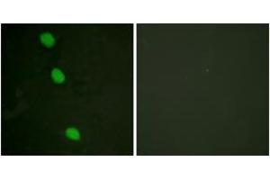 Immunofluorescence analysis of HeLa cells, using CaMK4 (Phospho-Thr196/200) Antibody. (CAMK4 抗体  (pThr200))