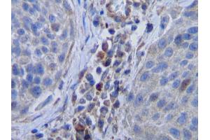 Immunohistochemistry (IHC) image for anti-Colony Stimulating Factor 1 (Macrophage) (CSF1) antibody (ABIN2475421)