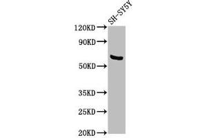Western Blot Positive WB detected in: SH-SY5Y whole cell lysate All lanes: PDP1 antibody at 3. (PDP 抗体  (AA 1-154))