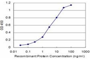 Detection limit for recombinant GST tagged PSPH is approximately 0. (PSPH 抗体  (AA 1-225))