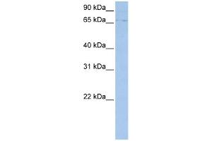 WB Suggested Anti-ABCF3 Antibody Titration:  0. (ABCF3 抗体  (N-Term))