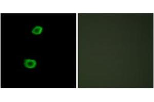 Immunofluorescence analysis of HepG2 cells, using LMTK2 Antibody. (LMTK2 抗体  (AA 651-700))
