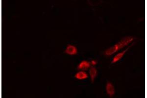 ABIN6274514 staining Hela cells by IF/ICC. (FKRP 抗体  (N-Term))