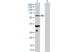 Western Blot analysis of TUBA1C expression in transfected 293T cell line by TUBA1C MaxPab polyclonal antibody. (TUBA1C 抗体  (AA 1-449))