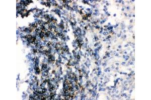 IHC-P: CD79b antibody testing of human tonsil tissue (CD79b 抗体  (AA 29-229))