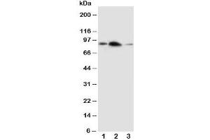 Western blot testing of APLP2 antibody and Lane 1:  rat brain;  2: rat heart;  3: human SMMC-7721 cell lysate