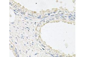 Immunohistochemistry of paraffin-embedded Human prostate using EPOR Polyclonal Antibody at dilution of 1:100 (40x lens). (EPOR 抗体)