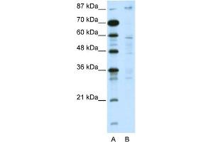 WB Suggested Anti-DMAP1 Antibody Titration:  5. (DMAP1 抗体  (C-Term))