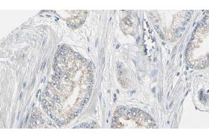 ABIN6272978 at 1/100 staining Human prostate tissue by IHC-P. (PYGL 抗体  (Internal Region))