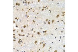Immunohistochemistry of paraffin-embedded rat brain using LBR antibody at dilution of 1:200 (40x lens). (Lamin B Receptor 抗体)