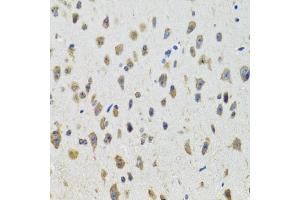 Immunohistochemistry of paraffin-embedded mouse brain using CYP19A1 antibody (ABIN5971188) at dilution of 1/100 (40x lens). (Aromatase 抗体)