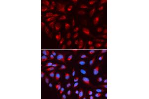 Immunofluorescence analysis of U2OS cell using CTBP1 antibody. (CTBP1 抗体)