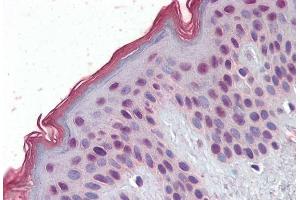 (ABIN334432) (2. (MBD2 抗体  (Internal Region))