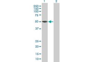 Western Blot analysis of ZCCHC12 expression in transfected 293T cell line by ZCCHC12 MaxPab polyclonal antibody. (ZCCHC12 抗体  (AA 1-402))