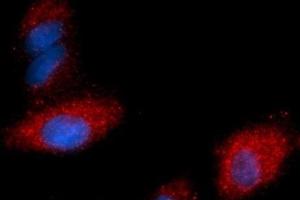 Immunofluorescence (IF) image for anti-Fatty Acid Binding Protein 4, Adipocyte (FABP4) (AA 1-132) antibody (PE) (ABIN5567676)