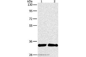 Western blot analysis of A431 and 231 cell, using ARTN Polyclonal Antibody at dilution of 1:350 (ARTN 抗体)