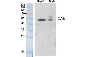 Western Blotting (WB) image for anti-Glucagon-Like Peptide 1 Receptor (GLP1R) (Internal Region) antibody (ABIN3184801) (GLP1R 抗体  (Internal Region))