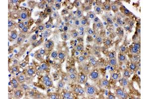 Catalase was detected in paraffin-embedded sections of mouse liver tissues using rabbit anti- Catalase Antigen Affinity purified polyclonal antibody (Catalog # ) at 1 ?